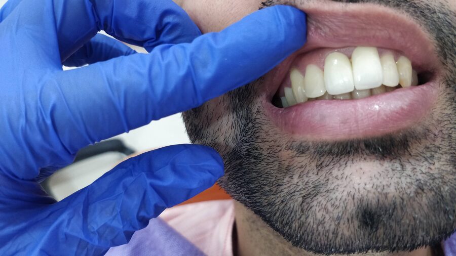 Comparison of a dental implant and a dental bridge